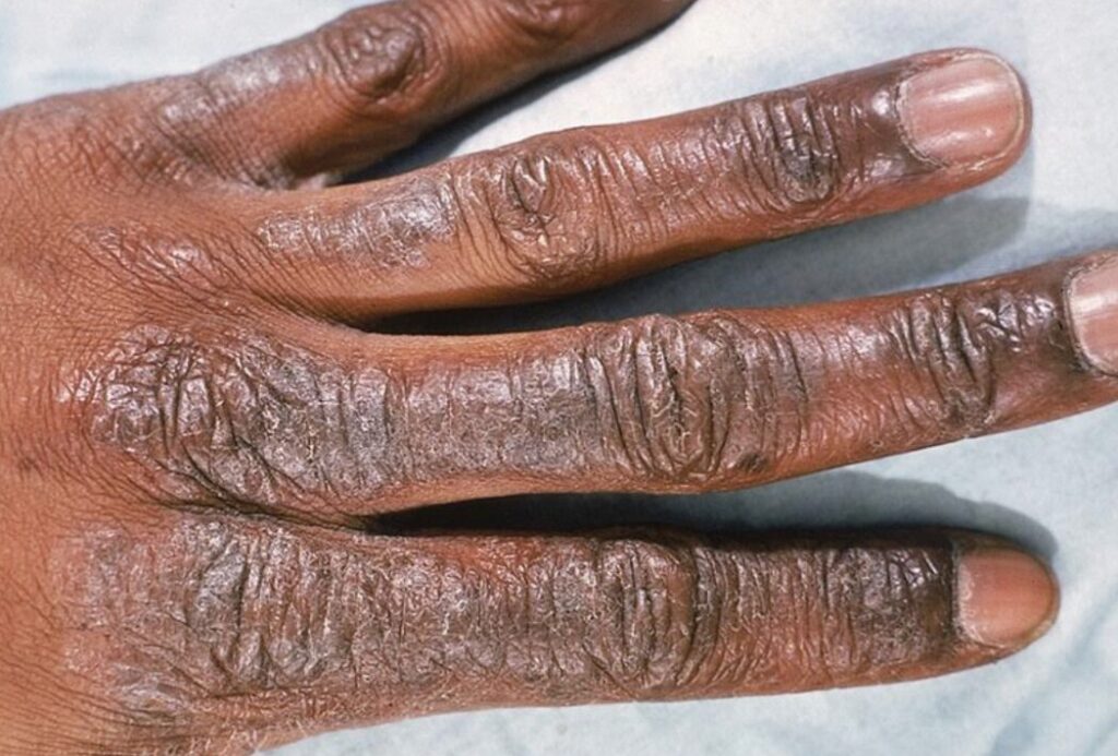 Dermatology Education screenshot 2025 11 01 at 4.55.48 am